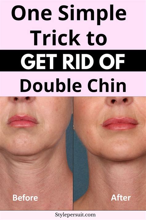 chi chi weight gain|How to Get Rid of a Double Chin .